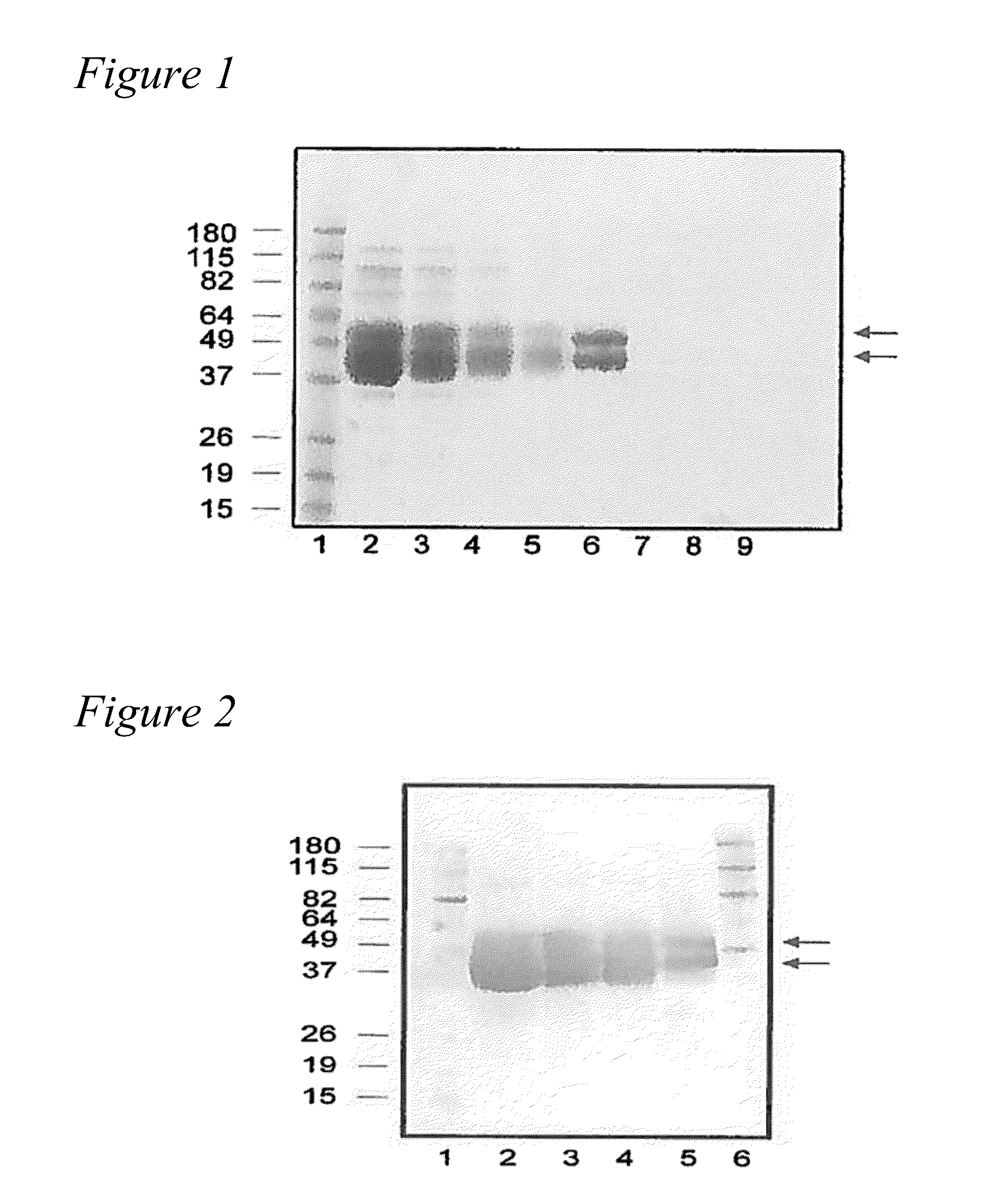 Formulations of human tissue kallikrein-1 for parenteral delivery and related methods