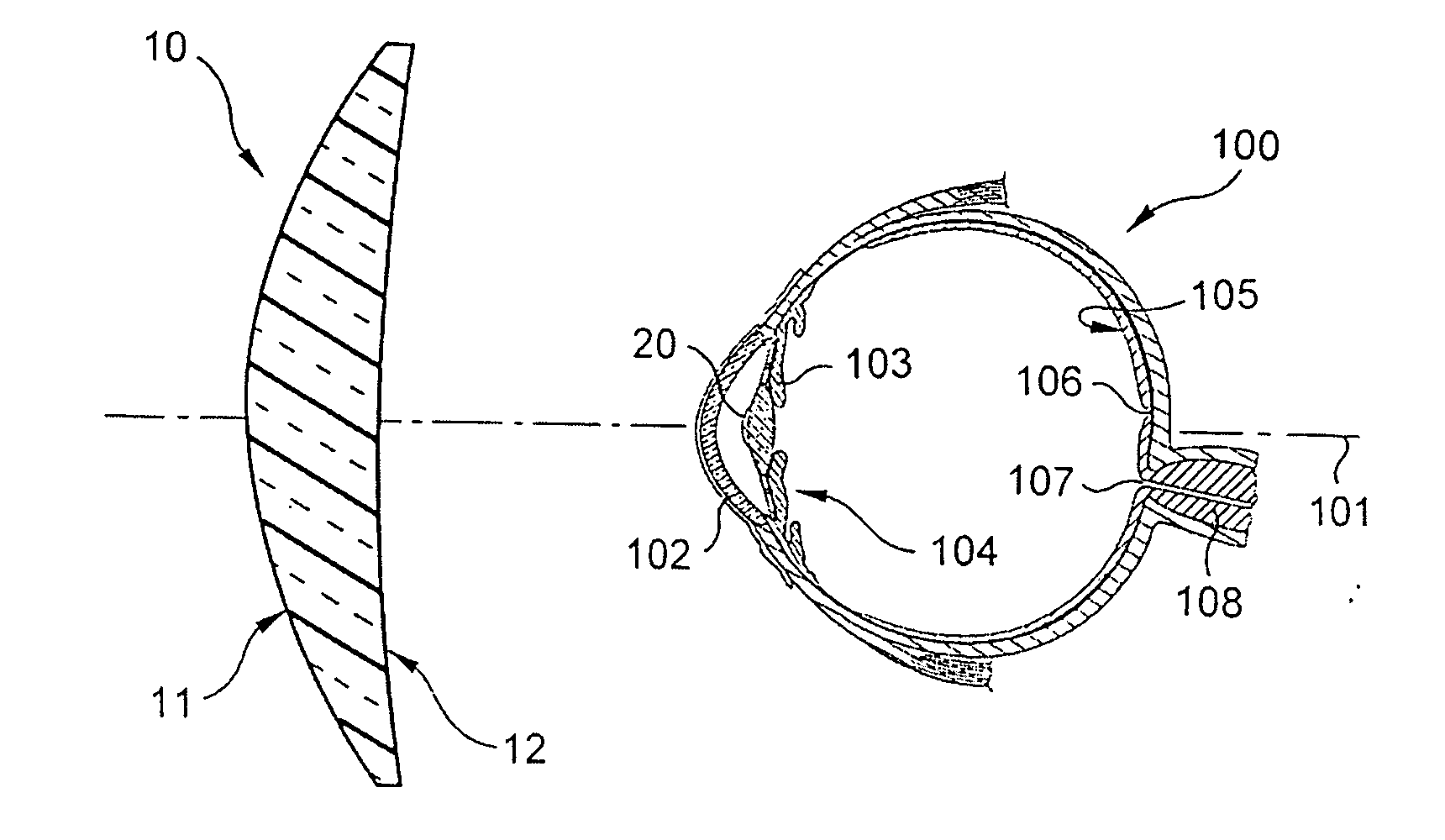 Optical accommodative compensation system