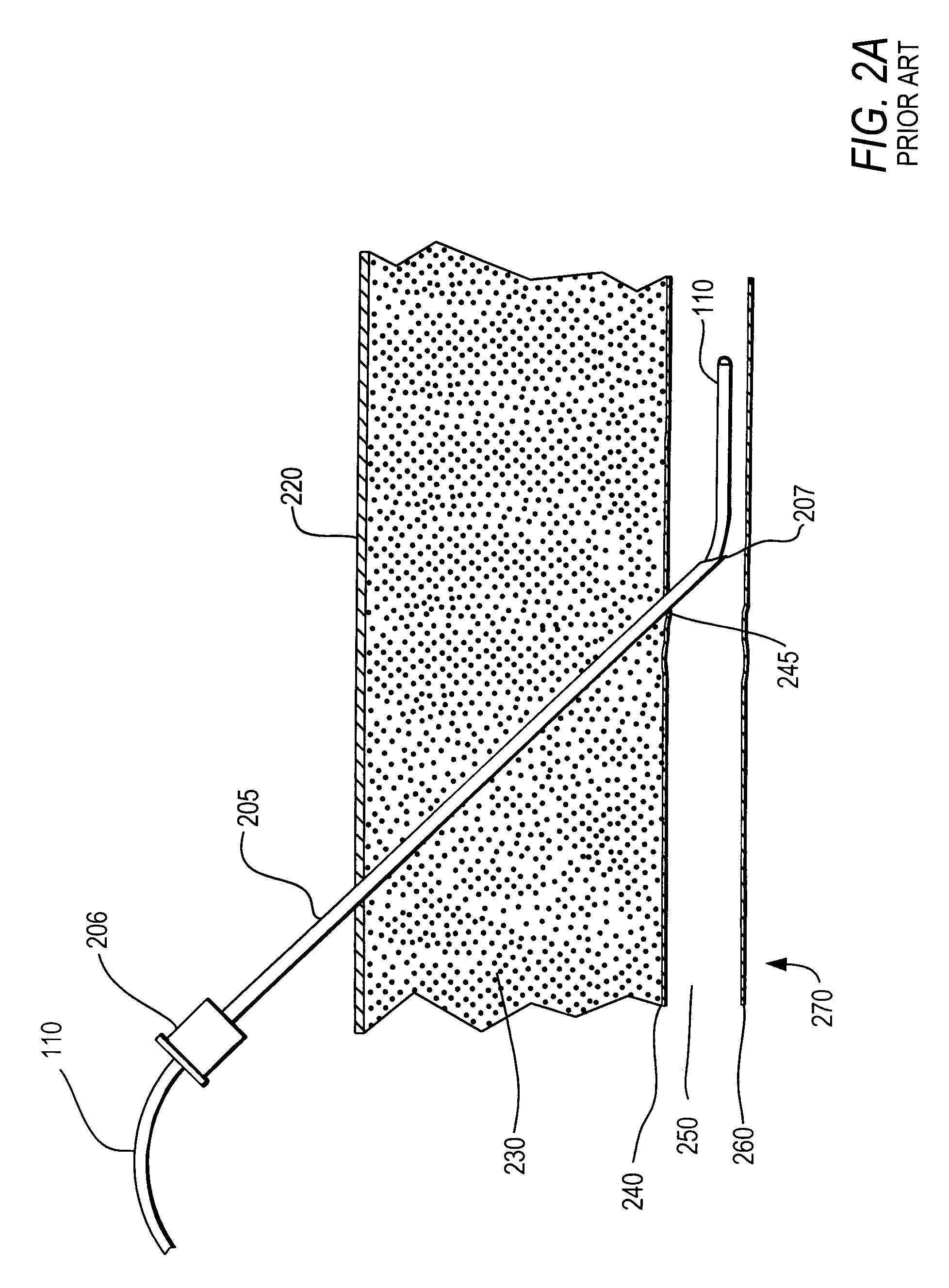 Medical guide element with diameter transition