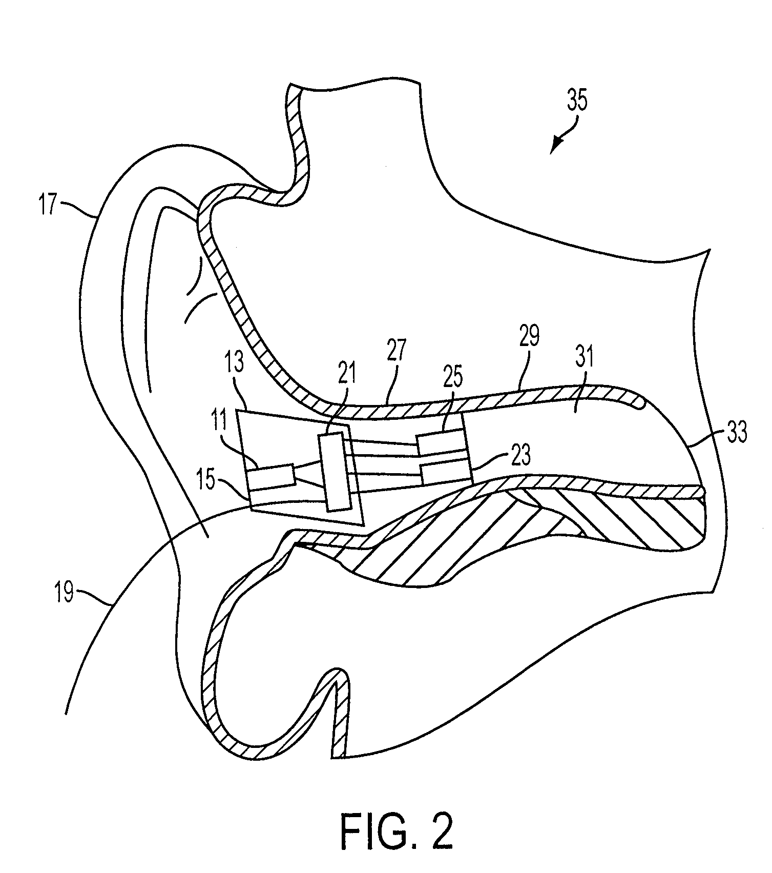 Earhealth monitoring system and method ii