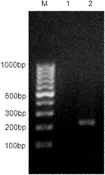 Recombinant antigenic protein for diagnosing echinococcosis granulosus, preparation method thereof and use thereof