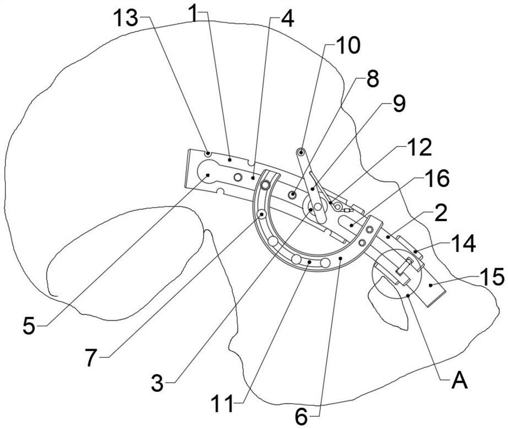 Fixing device for fractures of acetabulum anterior and posterior columns