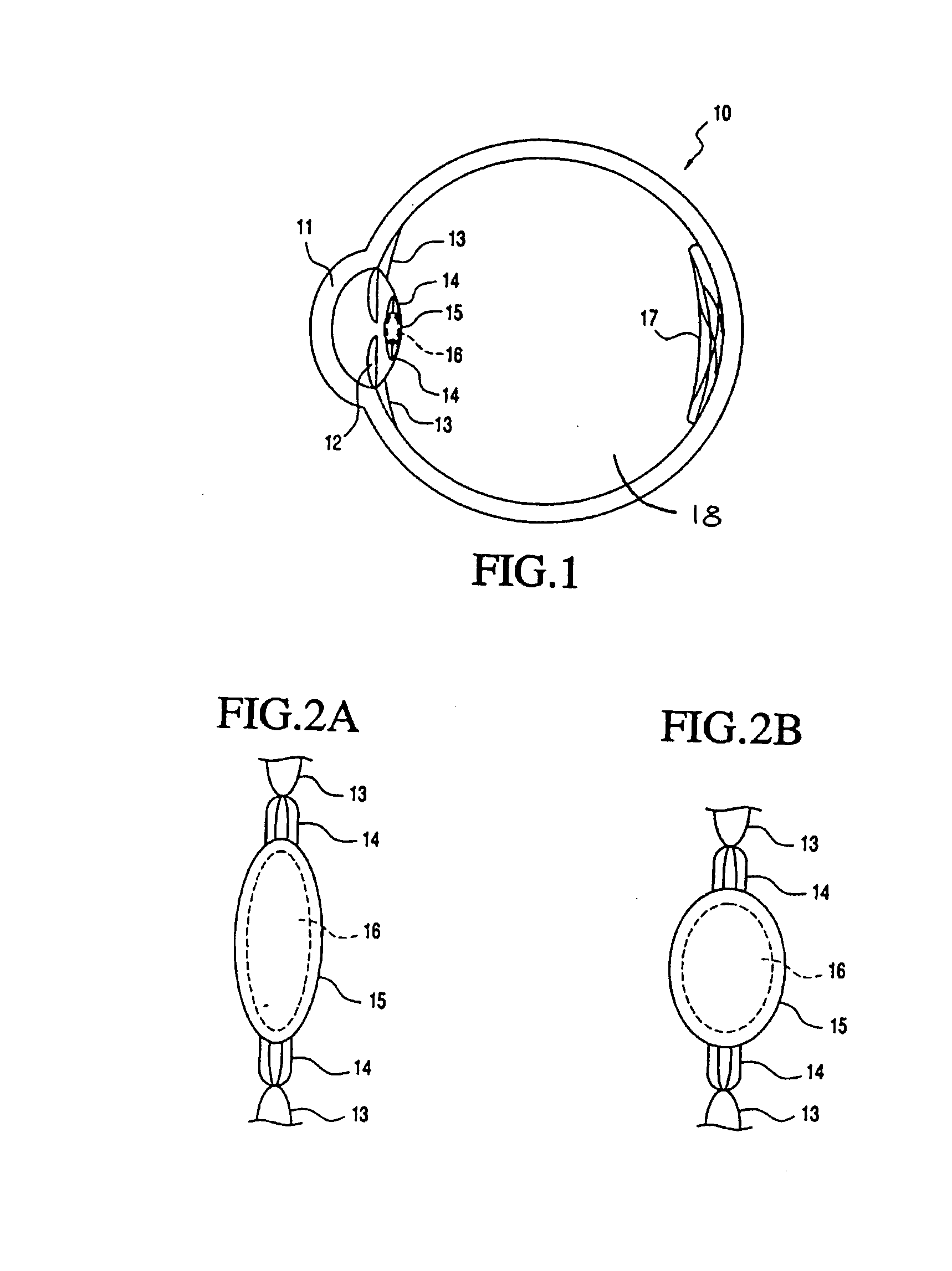 Accommodating intraocular lens system having spherical aberration compensation and method