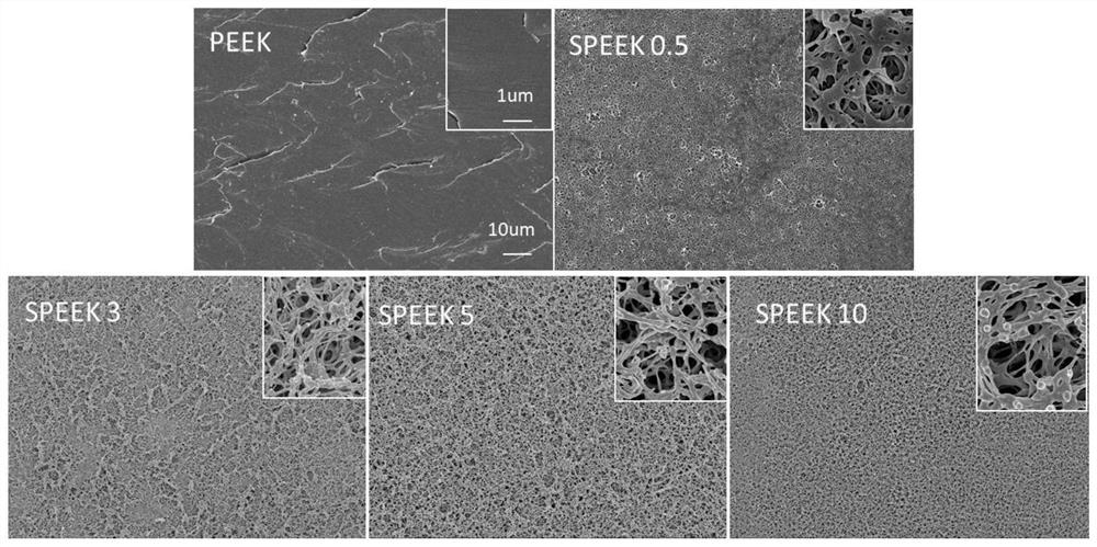 Polyether-ether-ketone three-dimensional porous and modified polydopamine/gentamicin for anti-bacteria and and anti-inflammation effects and promotion of osseointegration of implant