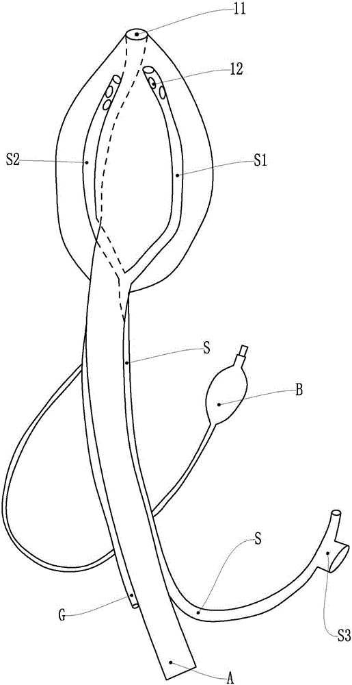 Laryngeal mask with multiple pipe cavities