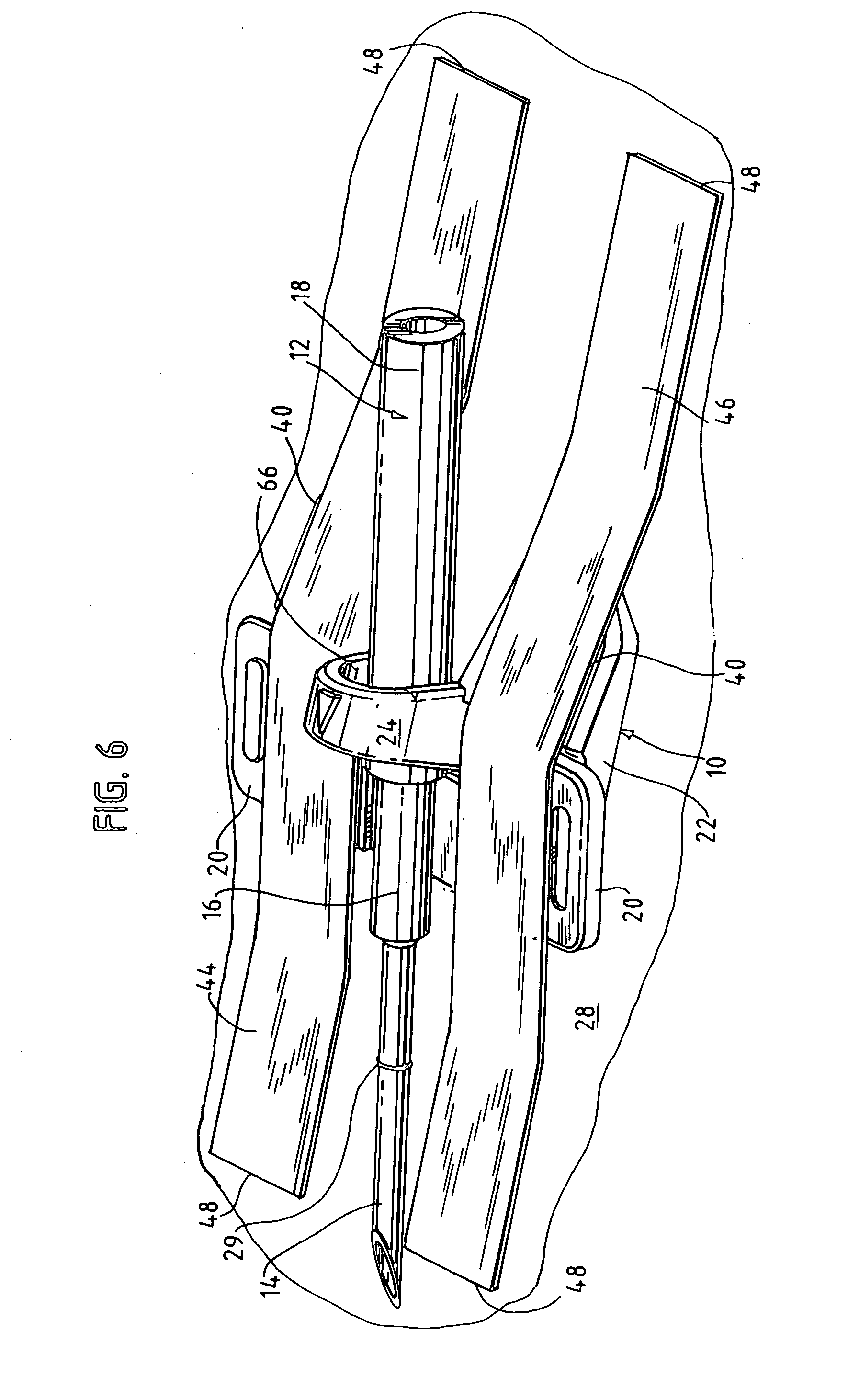 Needle alignment, needle securement and vessel stabilization device
