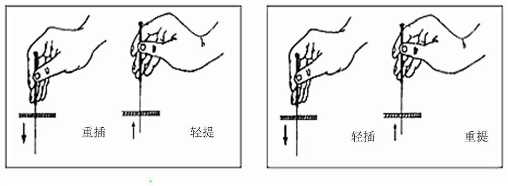 Acupuncture manipulation quantification system and method