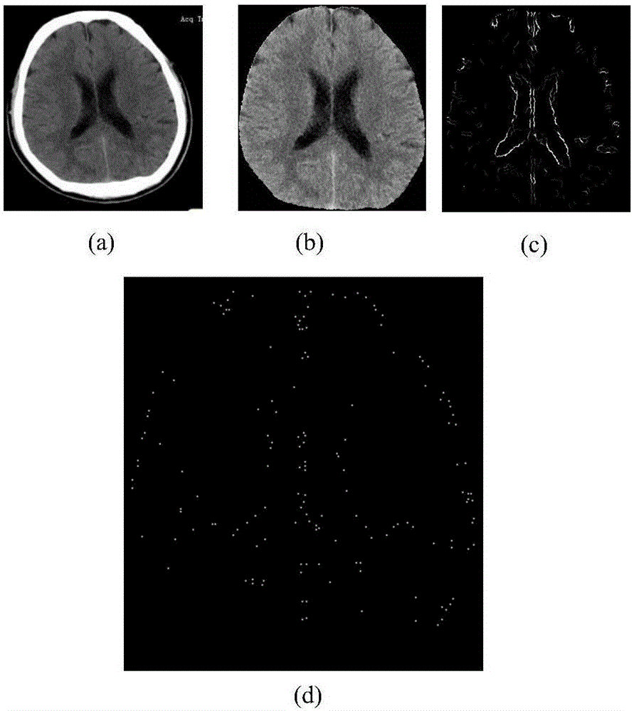 Medical image classification method based on corner matching