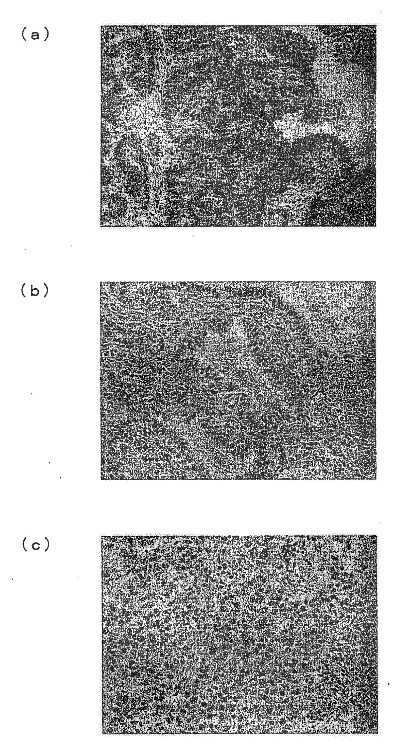 Tumor marker and use thereof