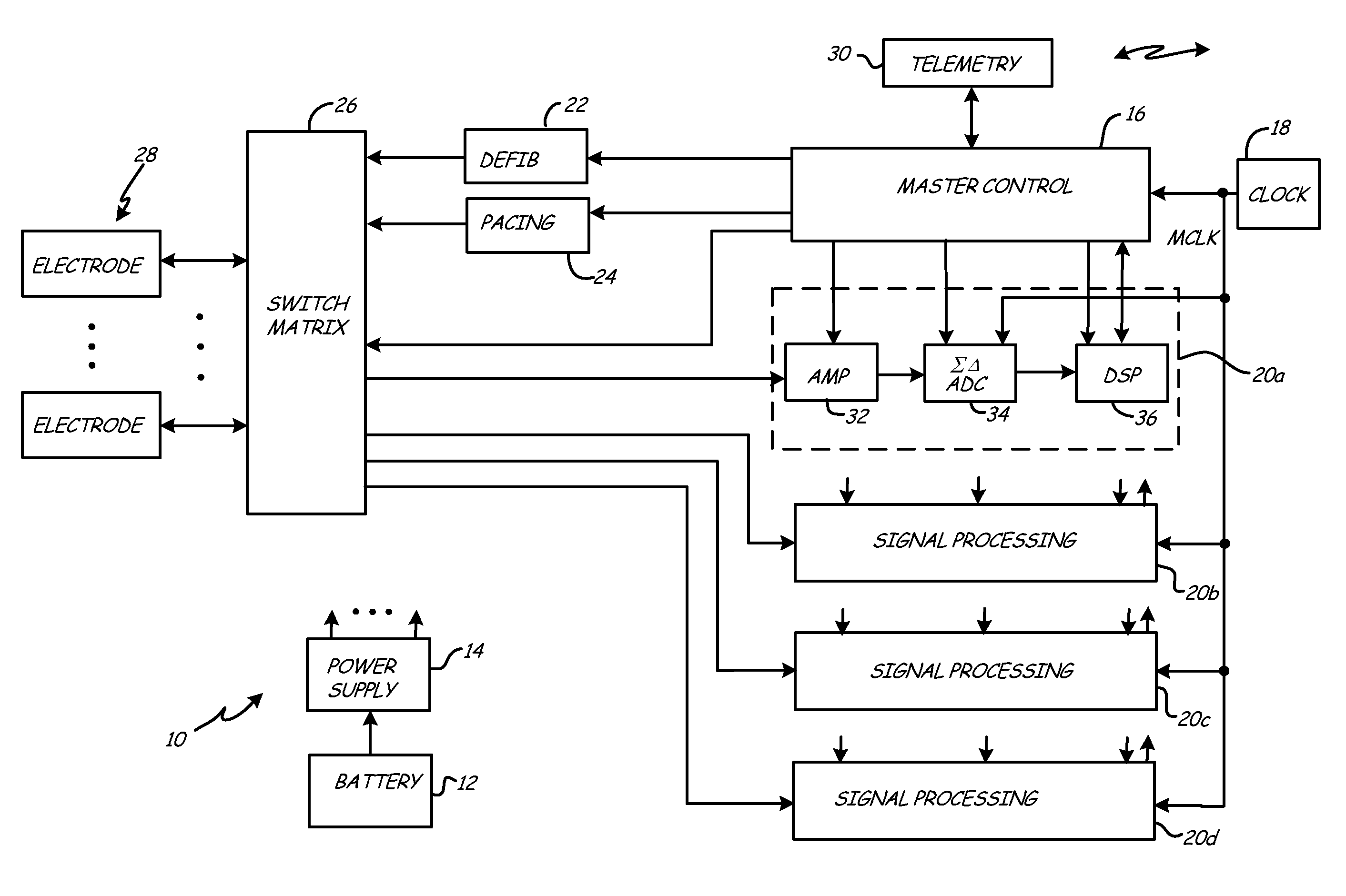 Implantable medical device with adjustable sigma-delta analog-to-digital conversion clock rate