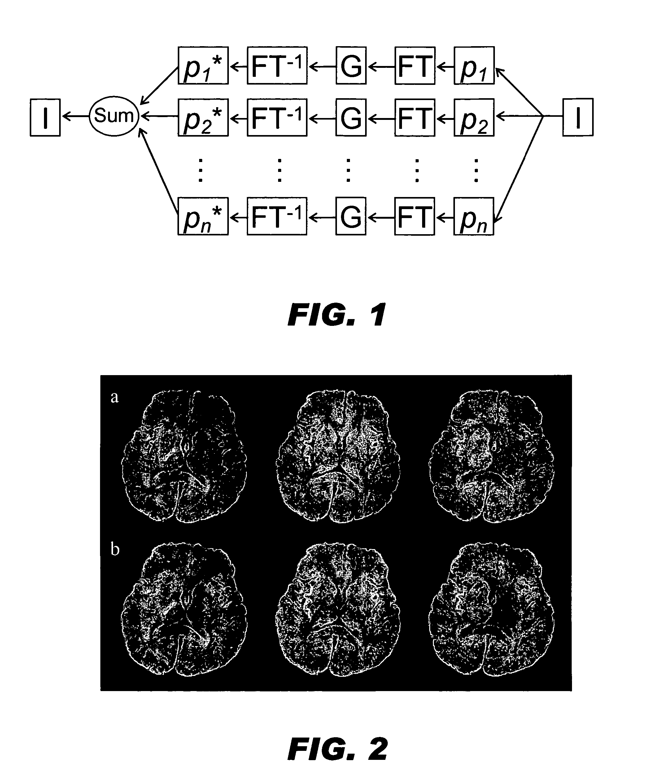Generalized MRI reconstruction with correction for multiple image distortion