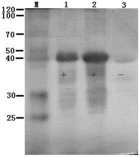 EF-Tu protein monoclonal antibody MAb of Brucella Melitensis and preparation method and application thereof
