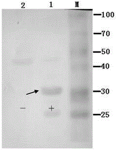 EF-Tu protein monoclonal antibody MAb of Brucella Melitensis and preparation method and application thereof