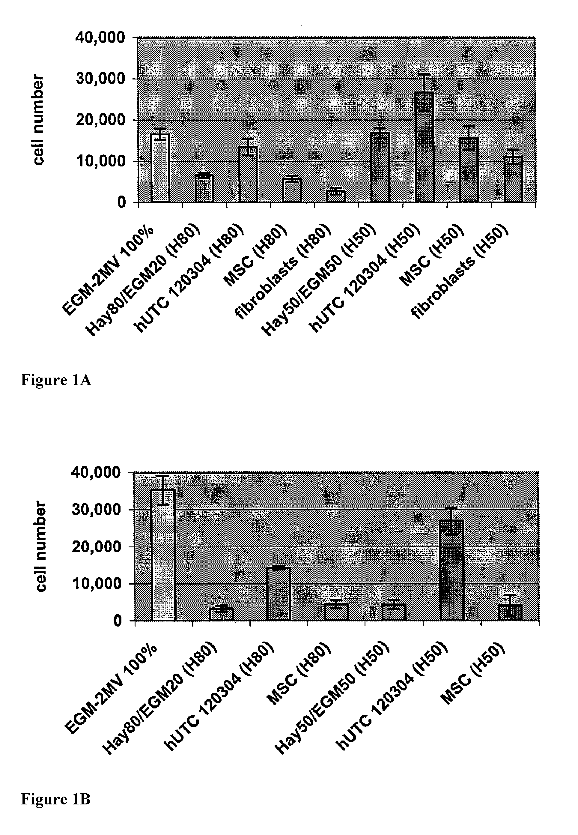 Treatment of peripheral vascular disease using umbilical cord tissue-derived cells