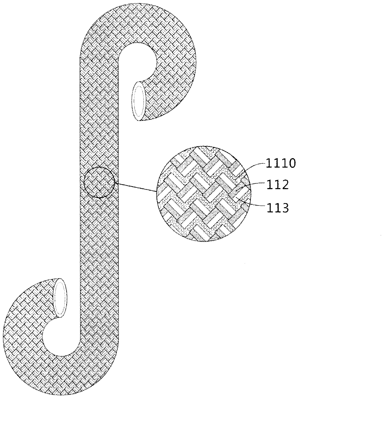 Textile multicomponent enhancement structure-gradually degradable ureteral stent tube and preparation method thereof