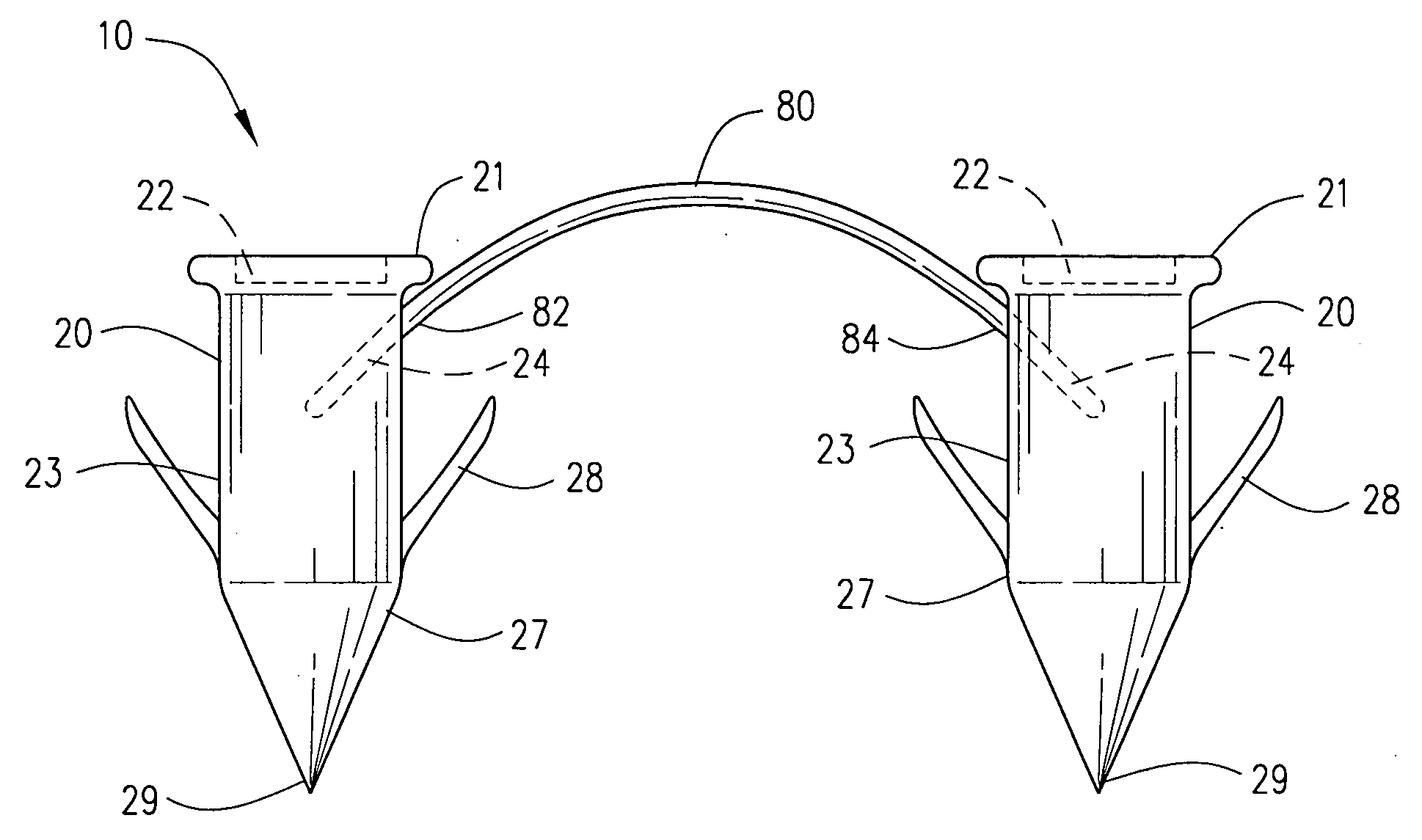Surgical suture staple and attachment device for securing a soft tissue to a bone