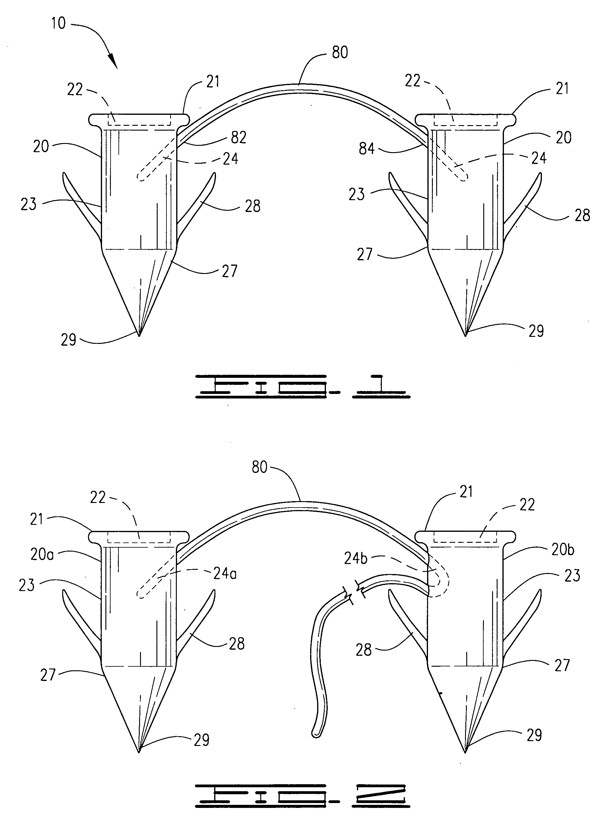 Surgical suture staple and attachment device for securing a soft tissue to a bone