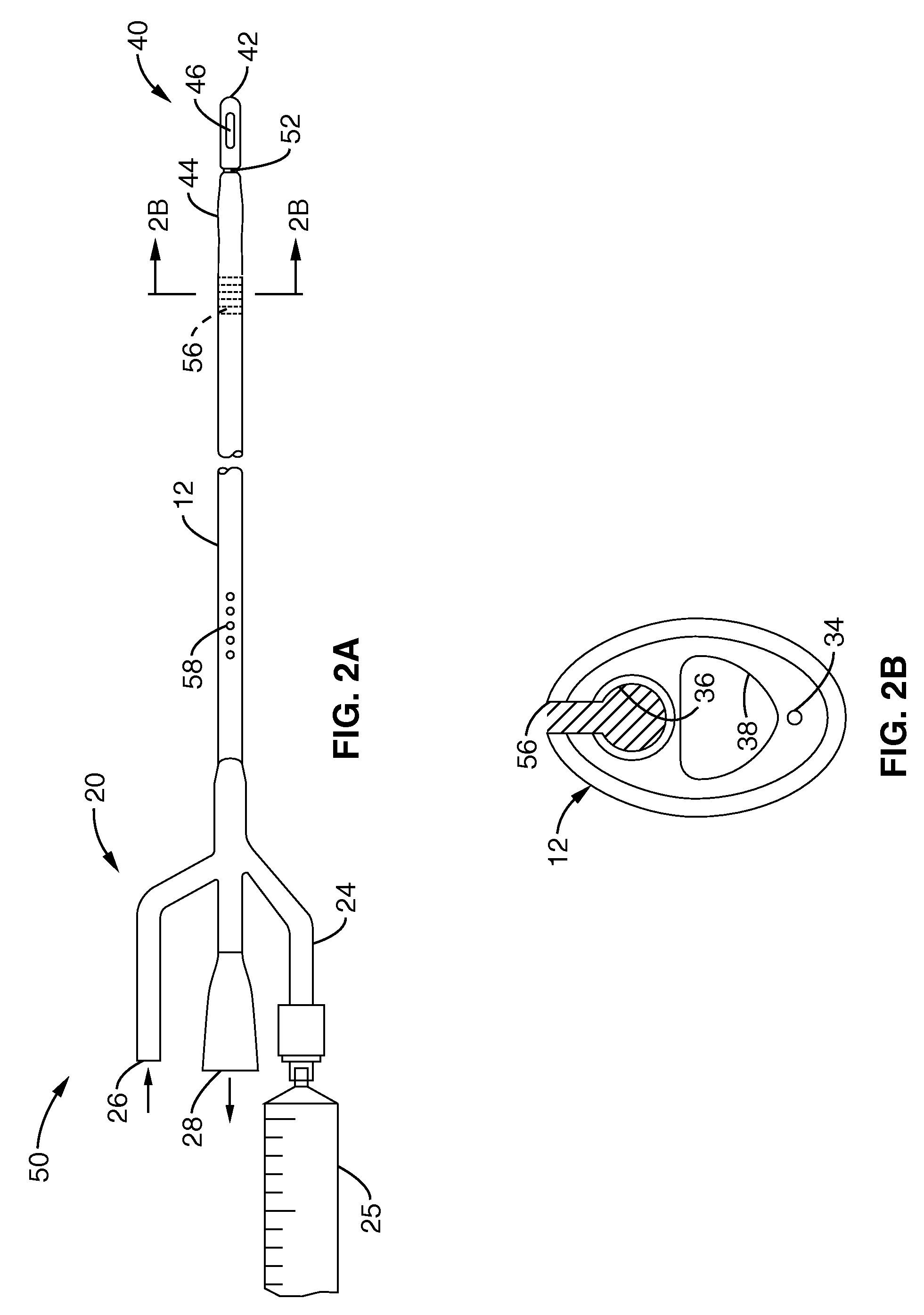 System and method for urinary tract cell collection, diagnosis, and chemotherapy