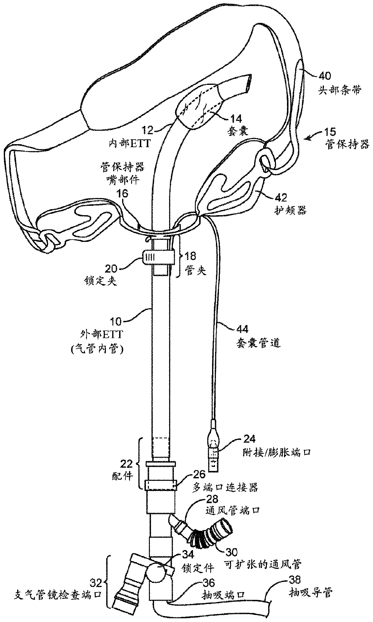 Endotracheal tube guard with optional holding system and optional sensor