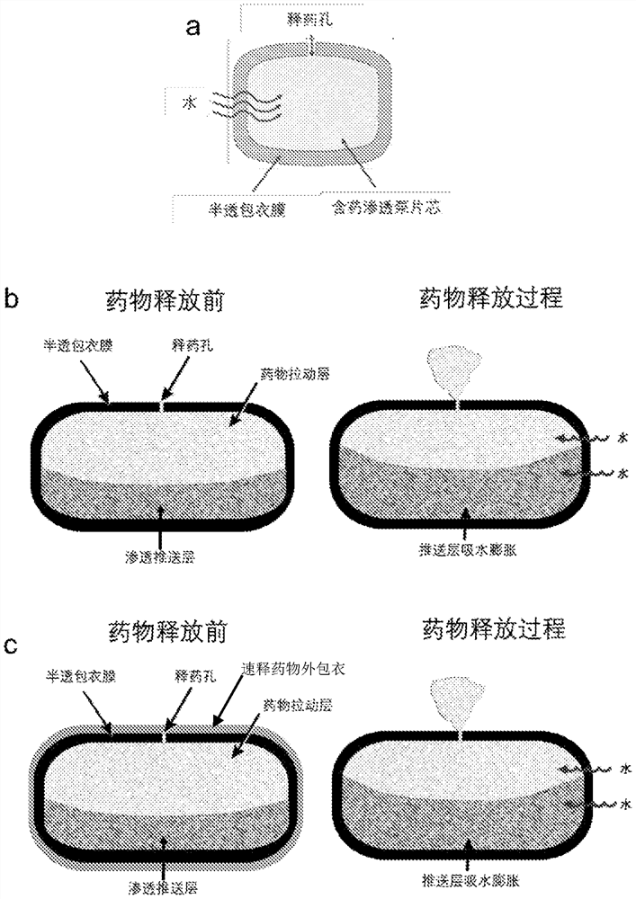 A kind of pharmaceutical composition and its preparation method and application