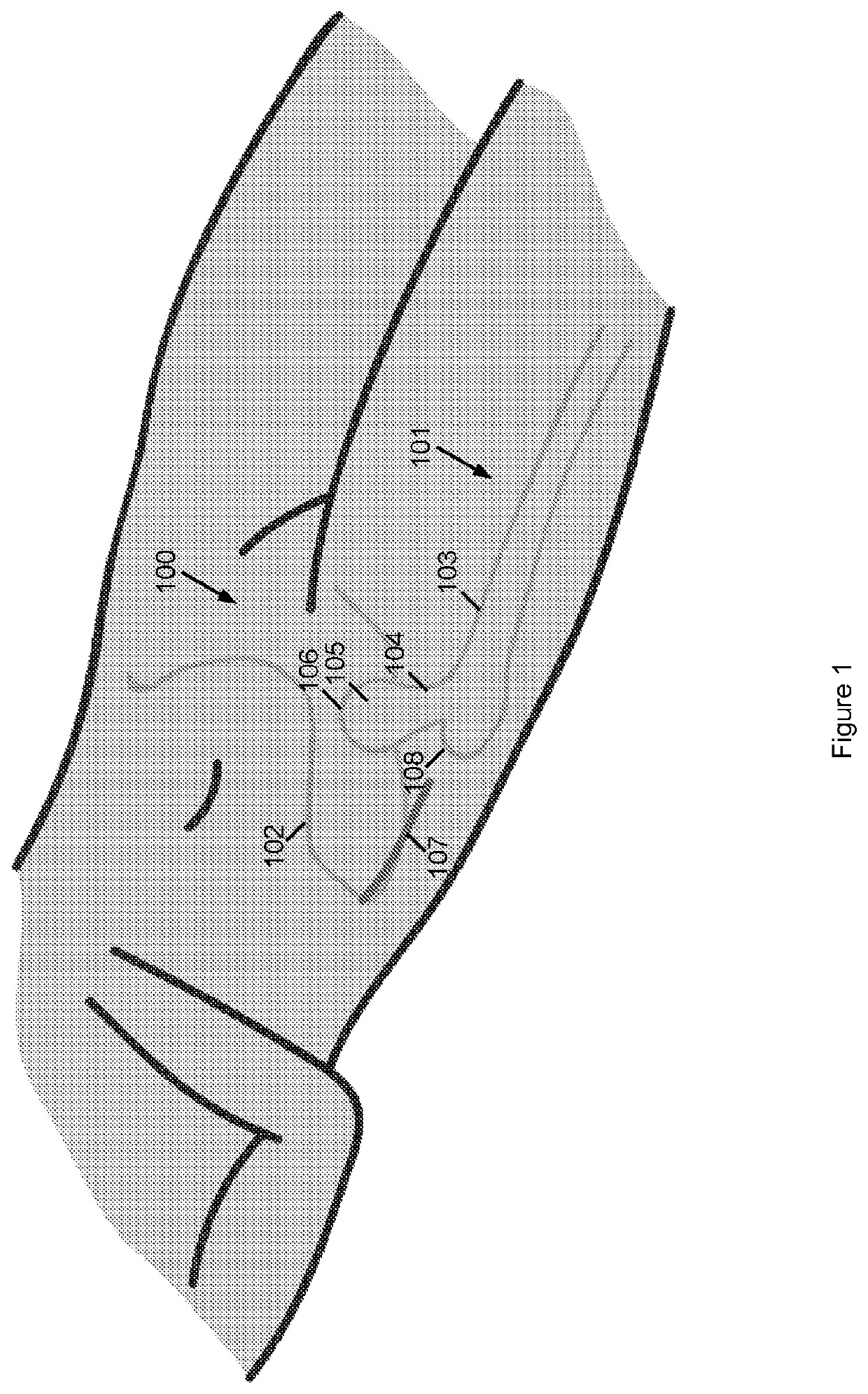 Minimally invasive hip arthroplasty techniques and apparatus