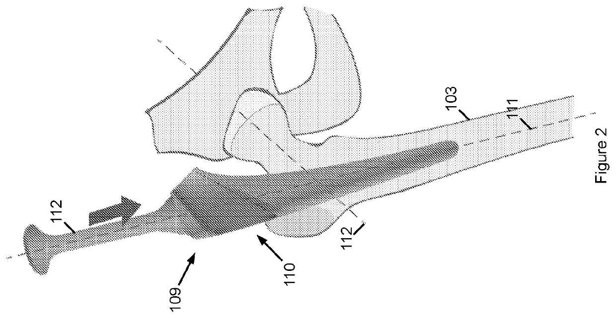 Minimally invasive hip arthroplasty techniques and apparatus