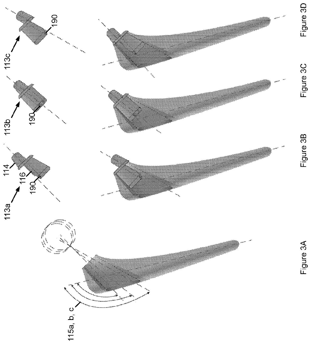 Minimally invasive hip arthroplasty techniques and apparatus