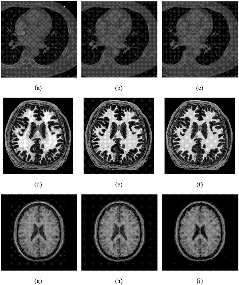 Fuzzy clustering medical image segmentation method having real-time performance