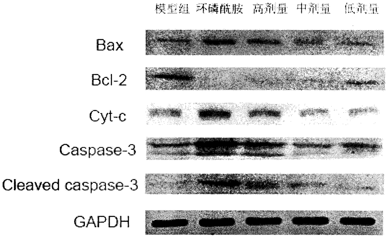 Traditional Chinese medicine composition used for treating liver cancer and hepatic cirrhosis