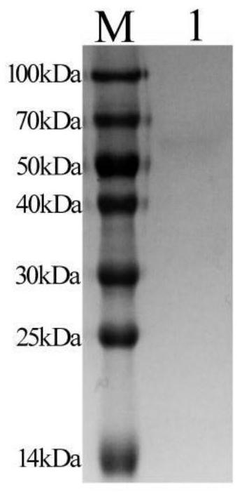 Colloidal gold test strip for detecting sheep fasciola hepatica infection circulating antigen