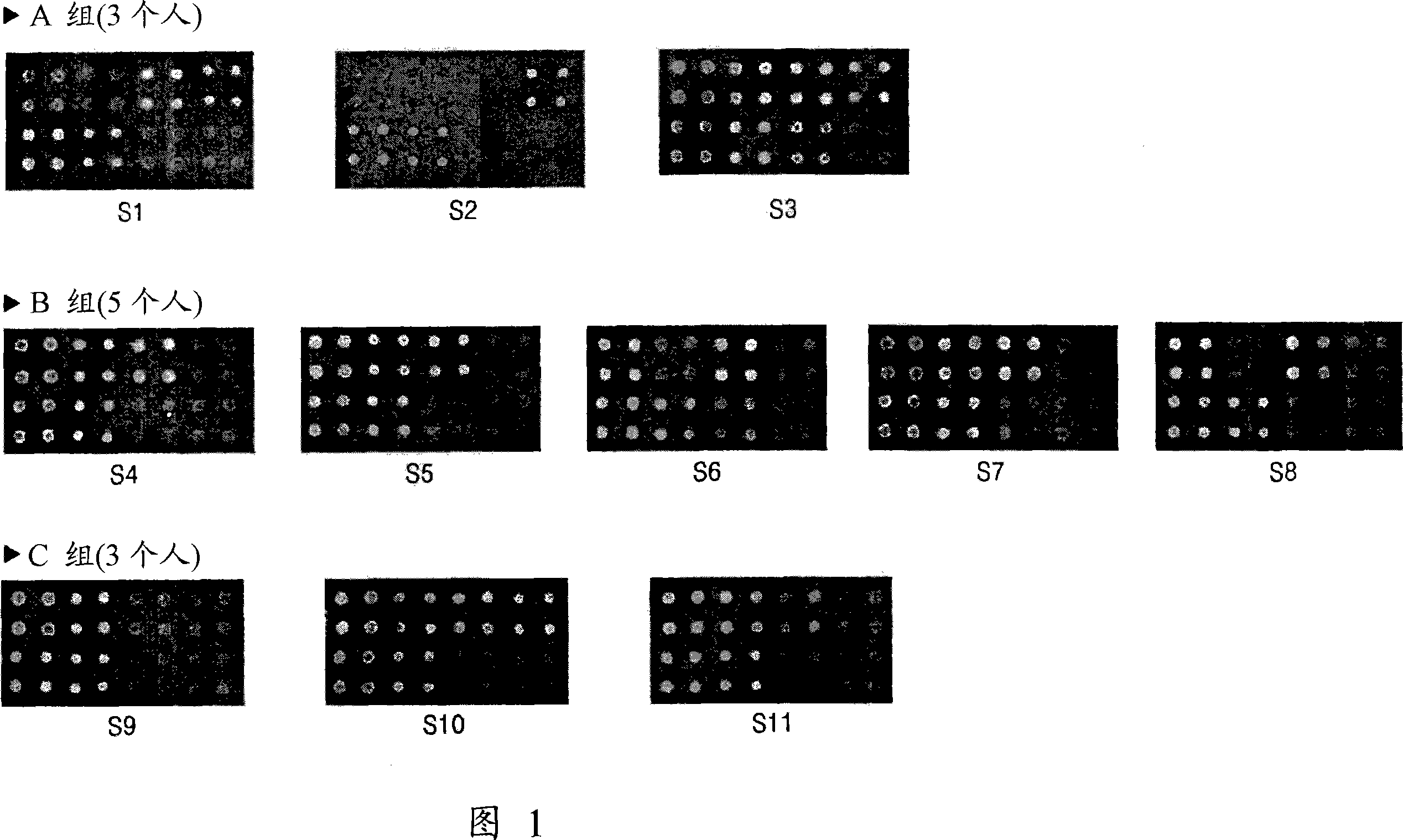 Primer group, probe or probe group, method and reagent box and micro-array for predicting alcohol degradation ability and hangover possibility