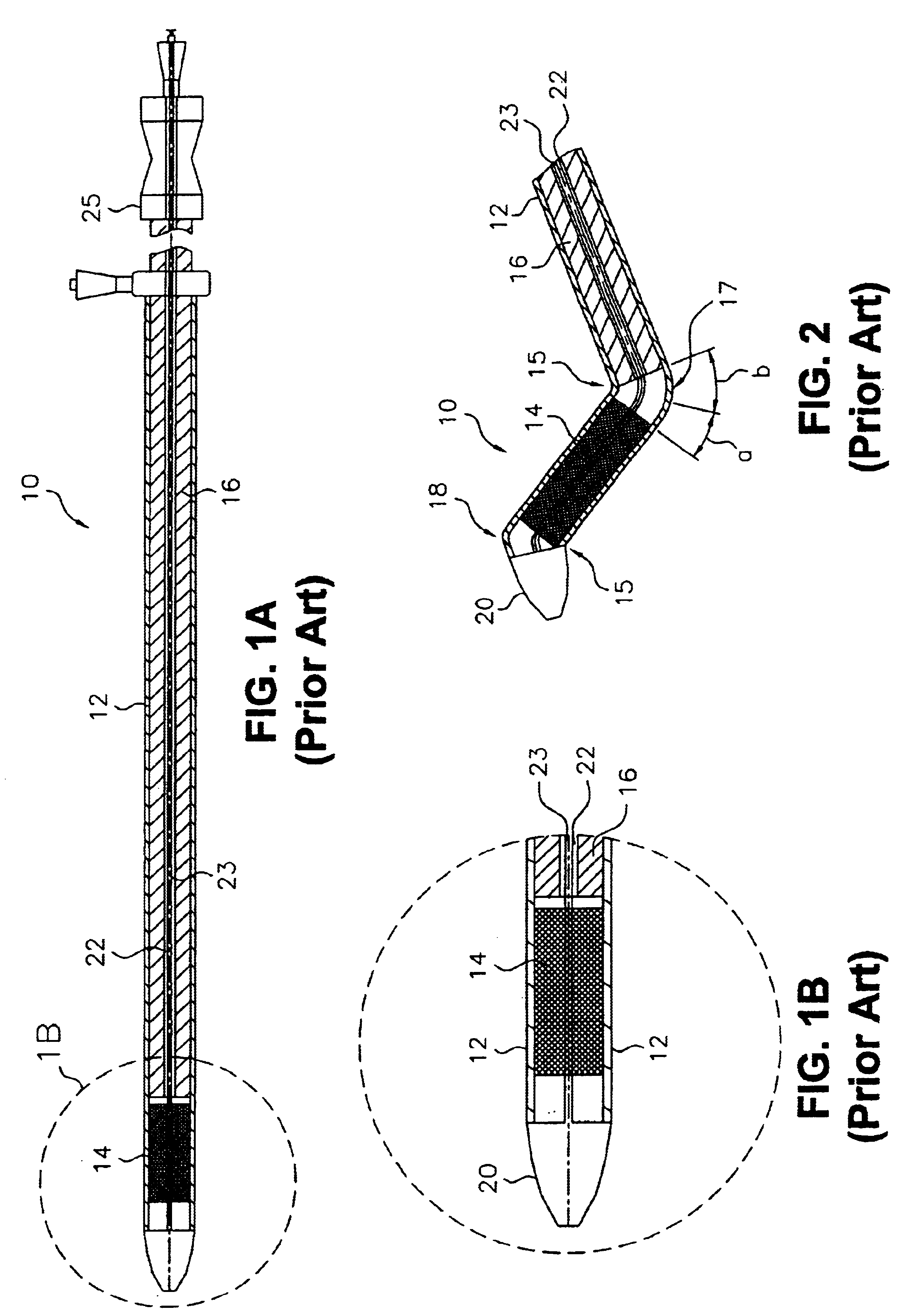 Stent delivery system for prevention of kinking, and method of loading and using same