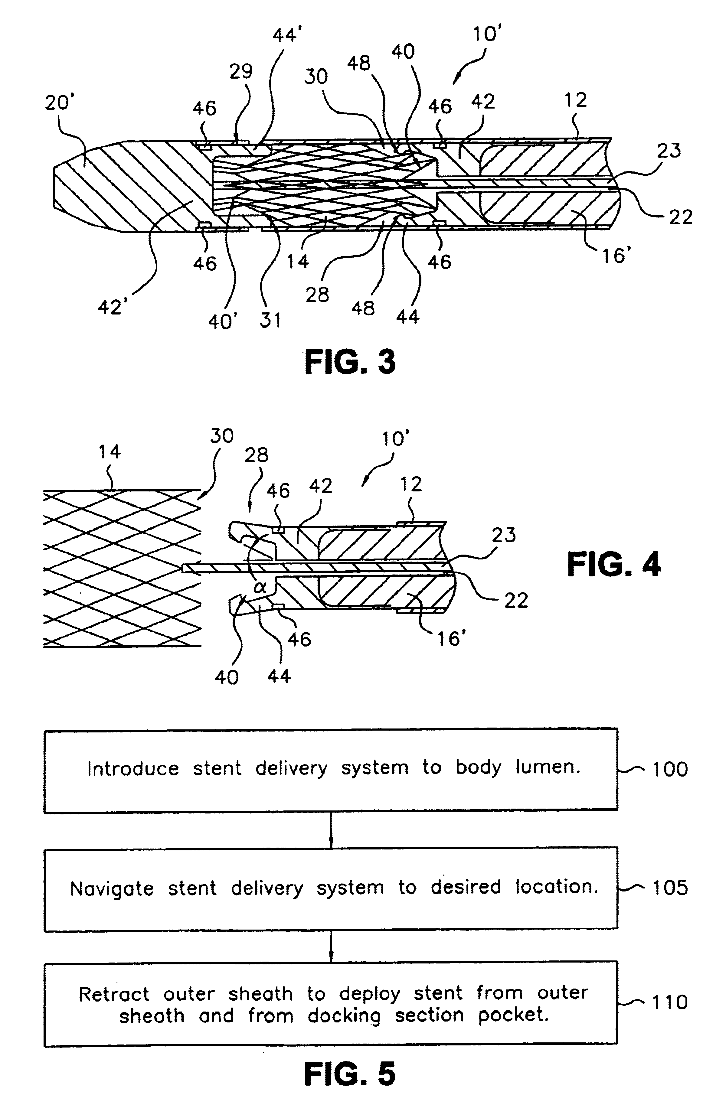 Stent delivery system for prevention of kinking, and method of loading and using same