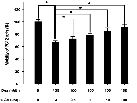 Application of teprenone in preparing medicine used for preventing and/or treating depression