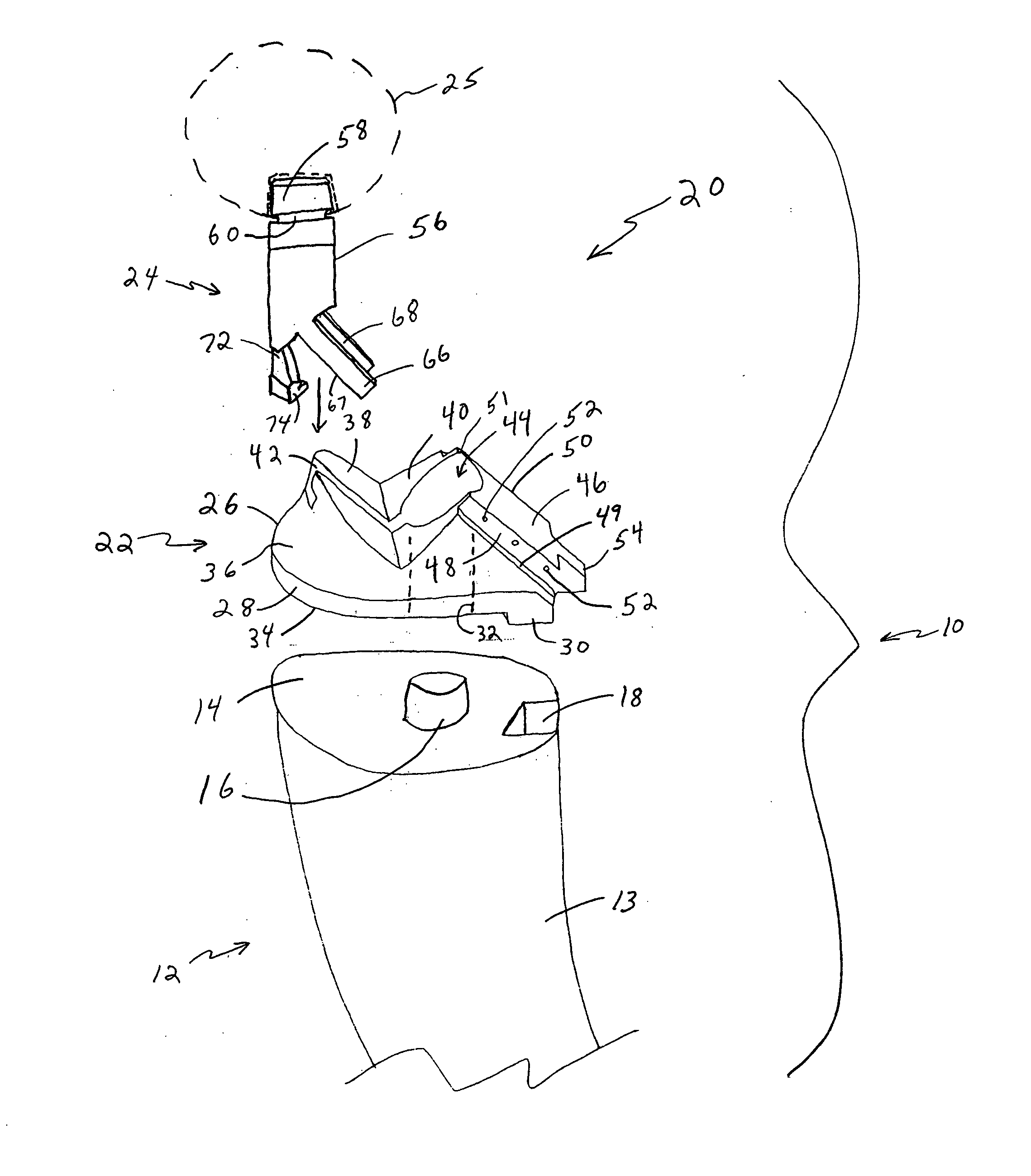 Modular trial neck segment