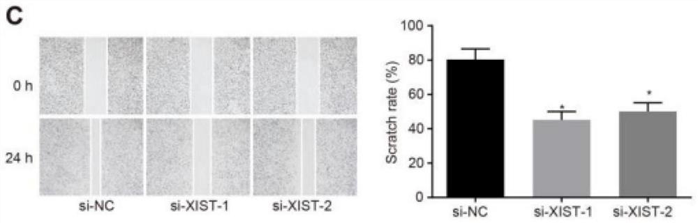 Application of LncRNA XIST and miR-132 combined with LncRNA XIST for inhibiting proliferation, invasion and metastasis of gastric cancer cells