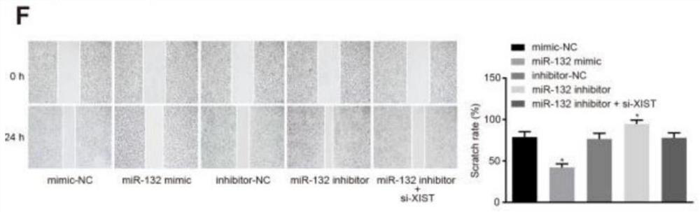 Application of LncRNA XIST and miR-132 combined with LncRNA XIST for inhibiting proliferation, invasion and metastasis of gastric cancer cells