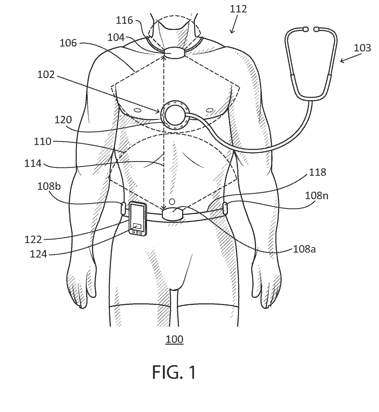 Medical attachment device tracking system and method of use thereof