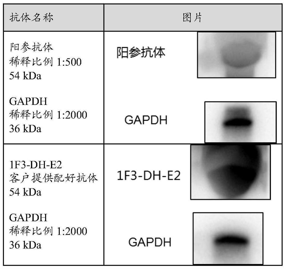 cBIN1 antibody and application thereof