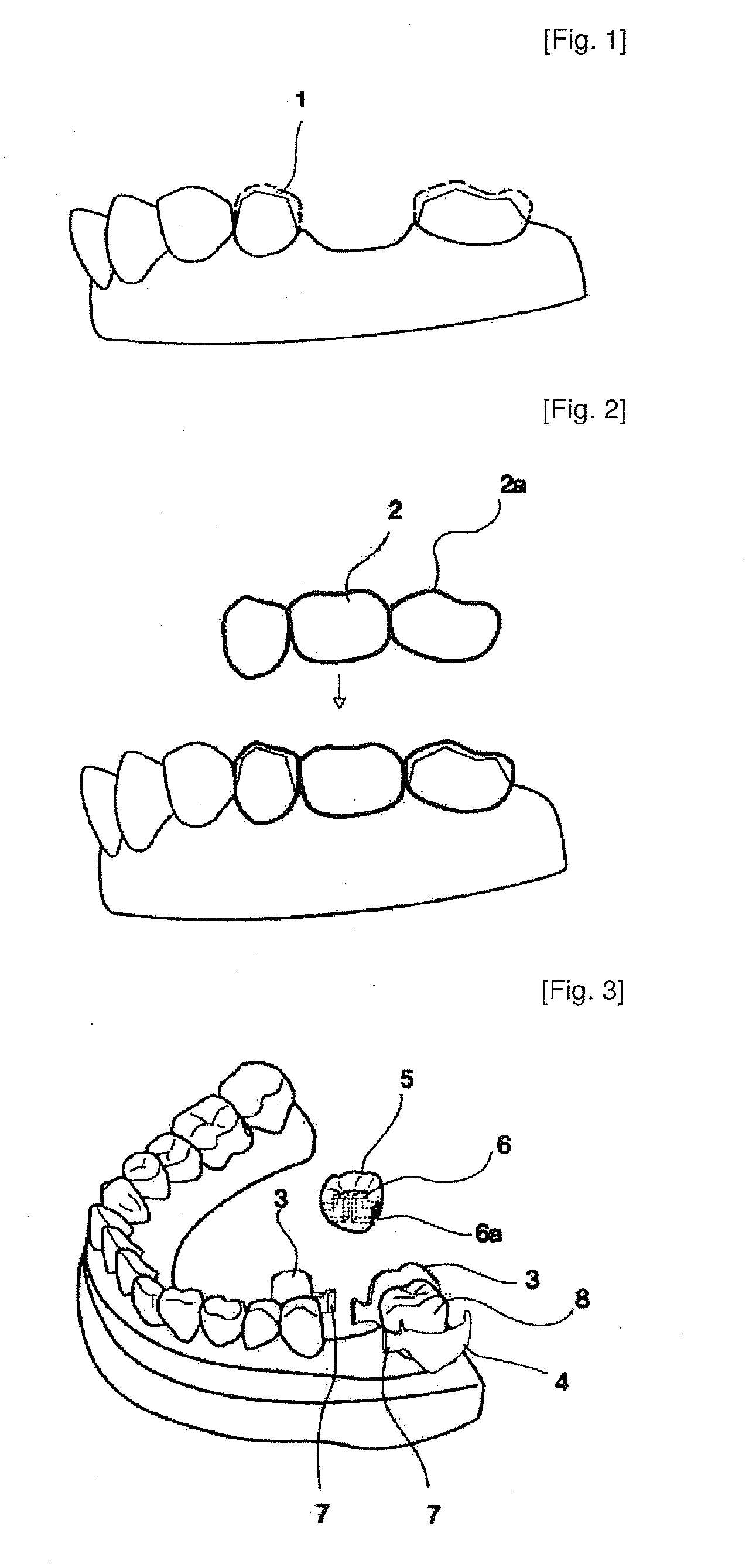 Dental prosthesis and its manufacturing method