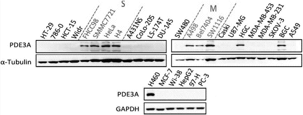 Applications of phosphodiesterase PDE3A in determination of tumor treatment effect of Anagrelide