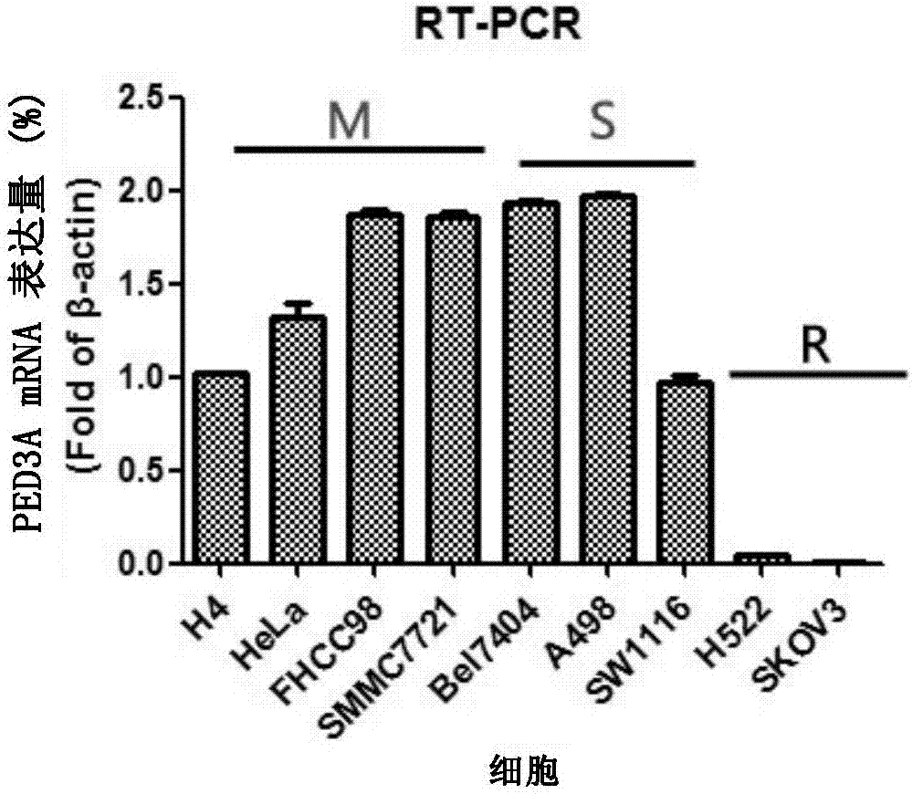 Applications of phosphodiesterase PDE3A in determination of tumor treatment effect of Anagrelide