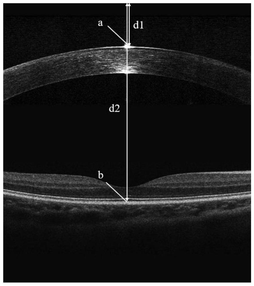 OCT-based eye axis measurement method and device