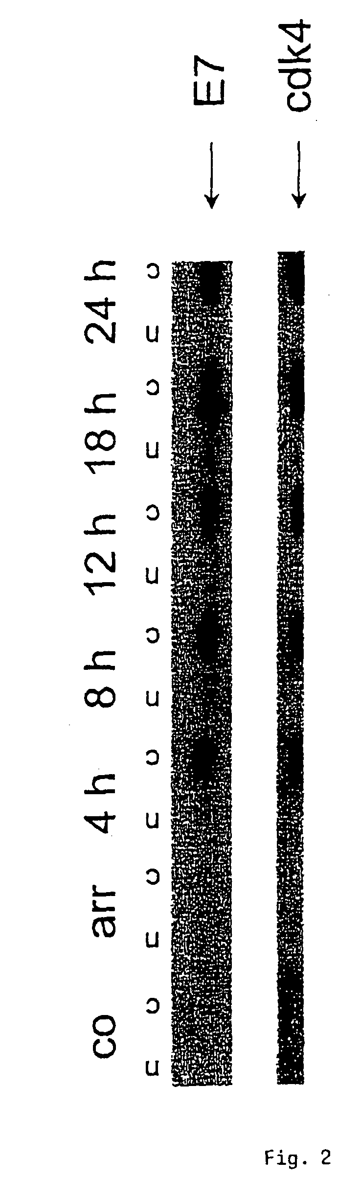 Method for detecting carcinomas in a solubilized cervical body sample