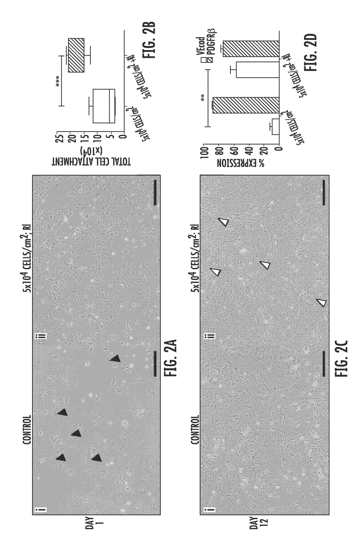 Three-dimensional vascular network assembly from induced pluripotent stem cells