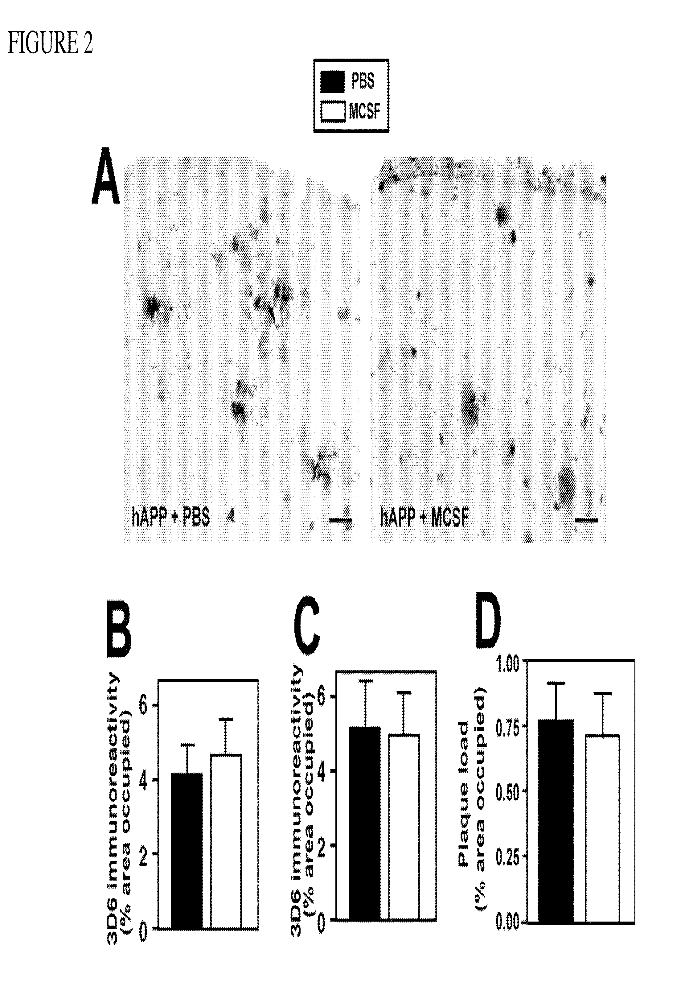 Methods of neuroprotection involving macrophage colony stimulating factor receptor agonists