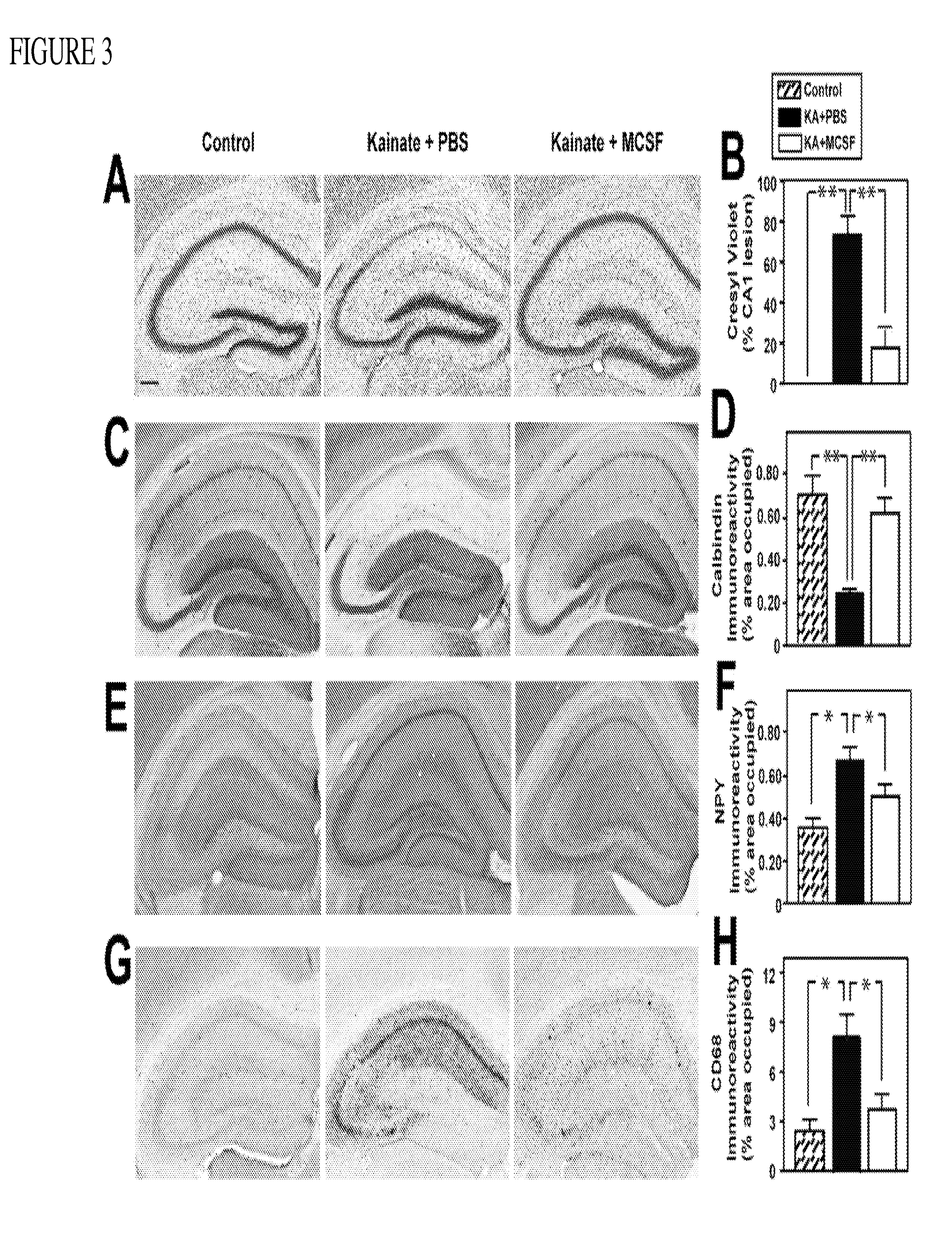 Methods of neuroprotection involving macrophage colony stimulating factor receptor agonists