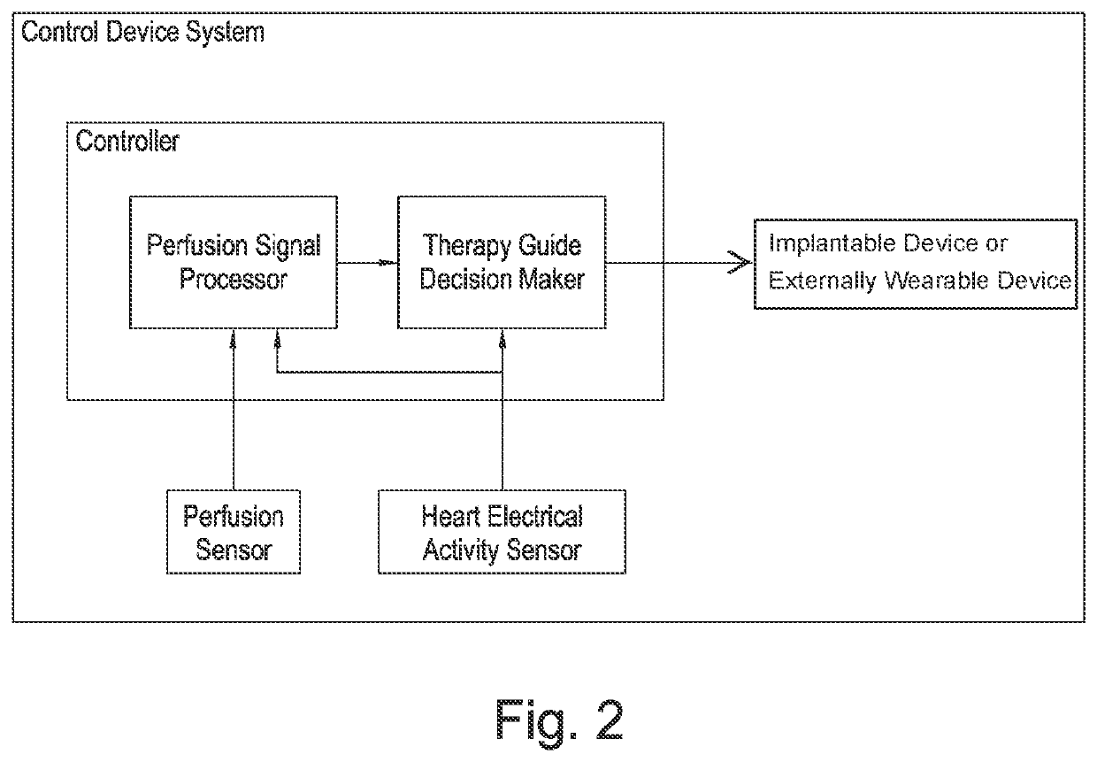 Method and an apparatus for determining hemodynamic status