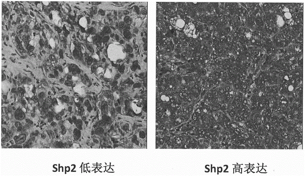 Application of Shp2 protein in preparation of kit for evaluating therapeutic effect of sorafenib on liver cancer