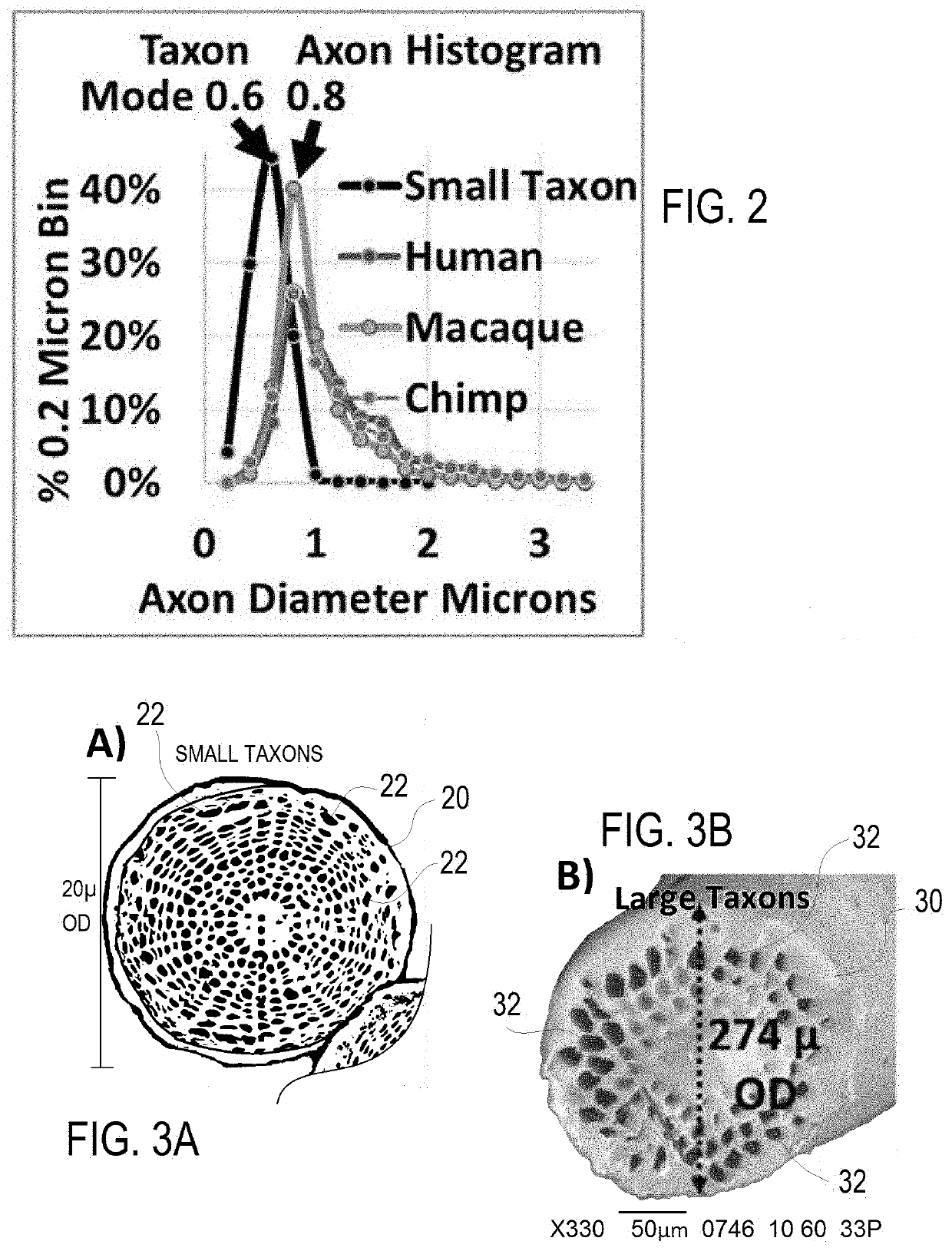 MRI phantom having filaments of integral textile axon simulations and anisotropic homogeneity MRI phantom using the filaments